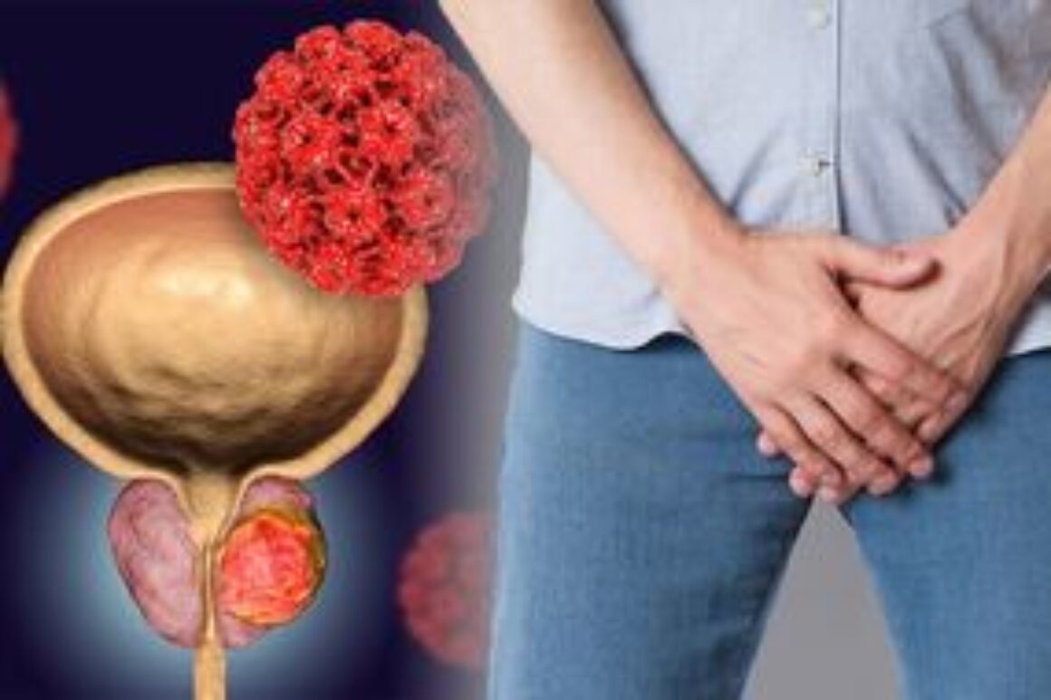 Prostate cancer – the sexual symptom you should never ignore
