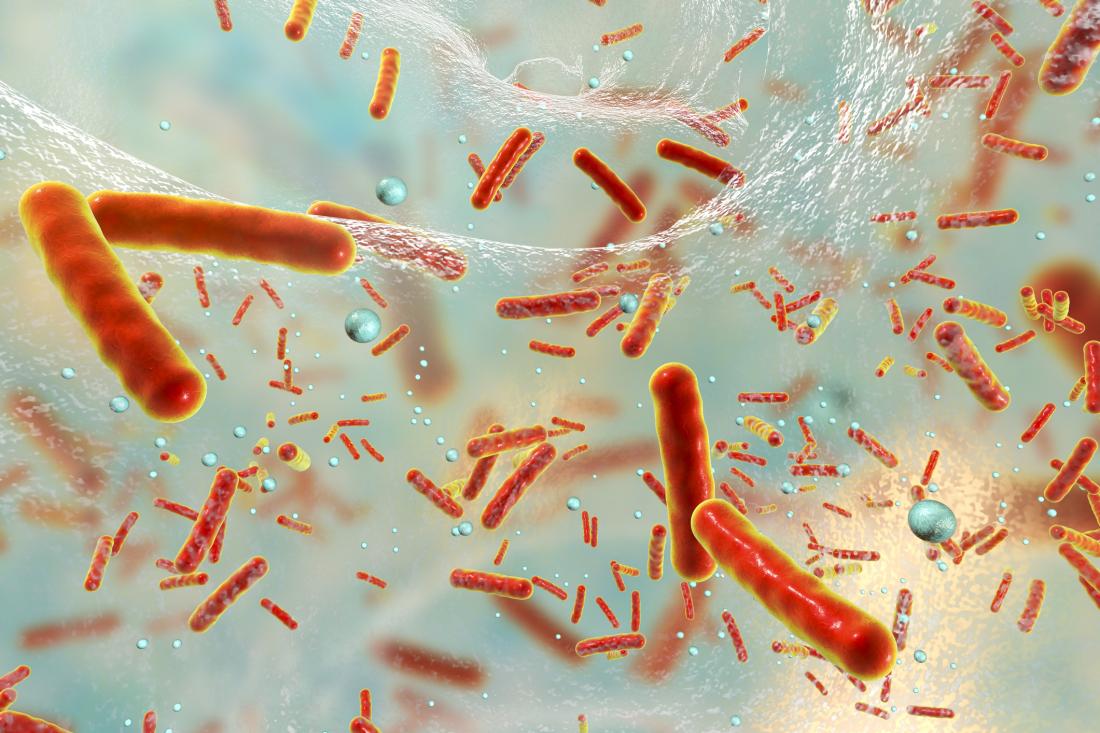 Do gut bacteria affect bowel cancer development?