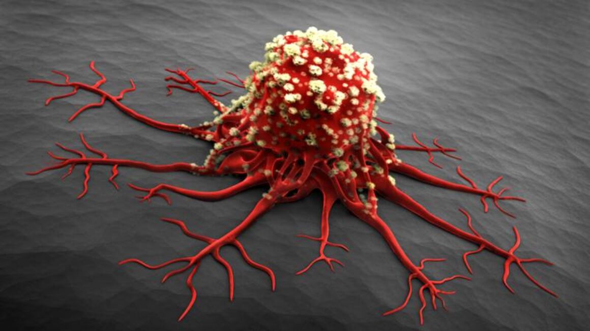 7 things you didn’t know could cause cancer